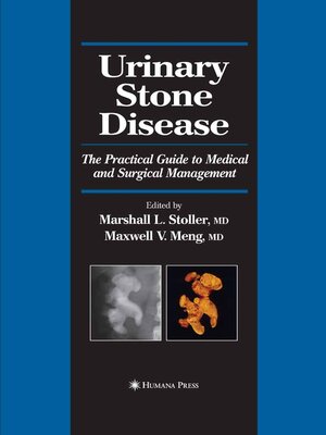 cover image of Urinary Stone Disease